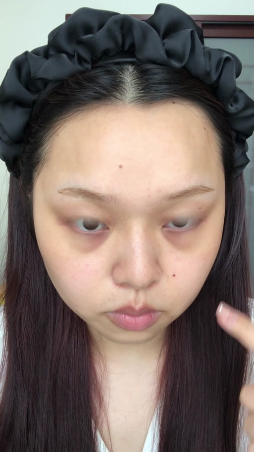 黑眼圈图片真人缩略图