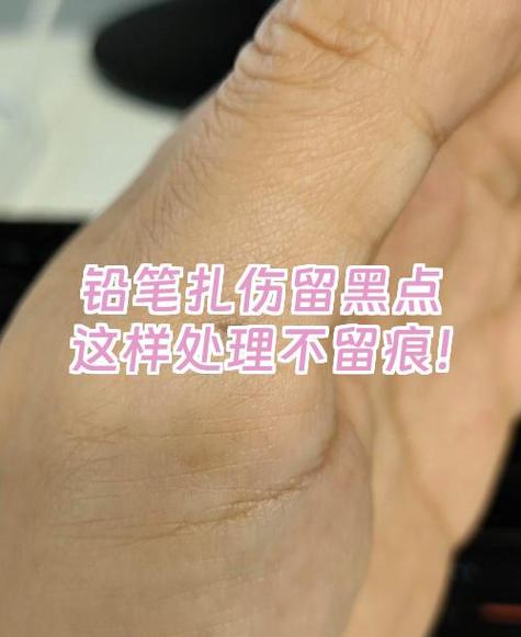 皮肤共享戳戳一周能用多少缩略图