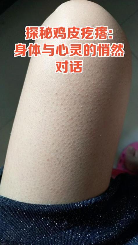 皮肉里有硬疙瘩