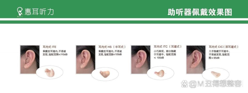 怎么让别人看到你在听歌