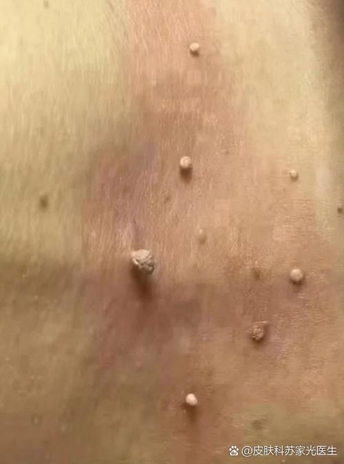 猪肉切开有红色肉疙瘩