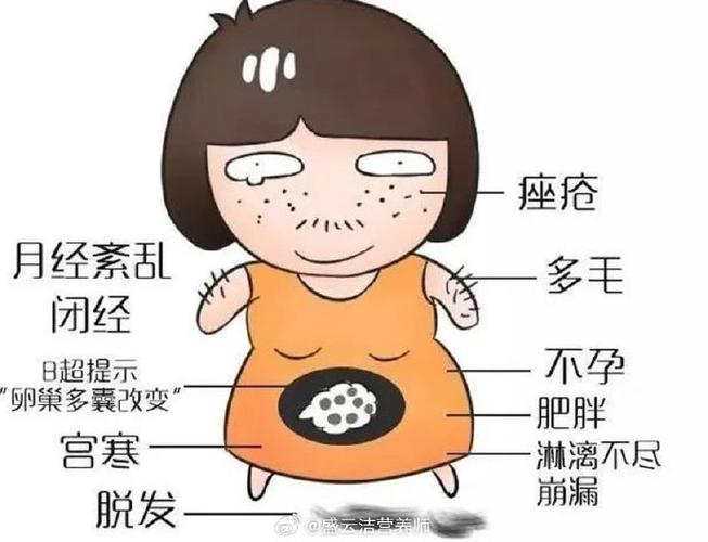漫画综合症