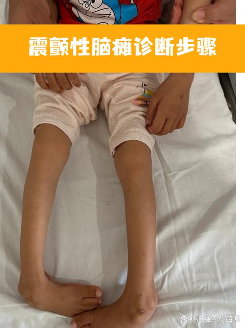 aapnh综合症