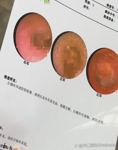 耳朵听到咚咚咚的声音缩略图