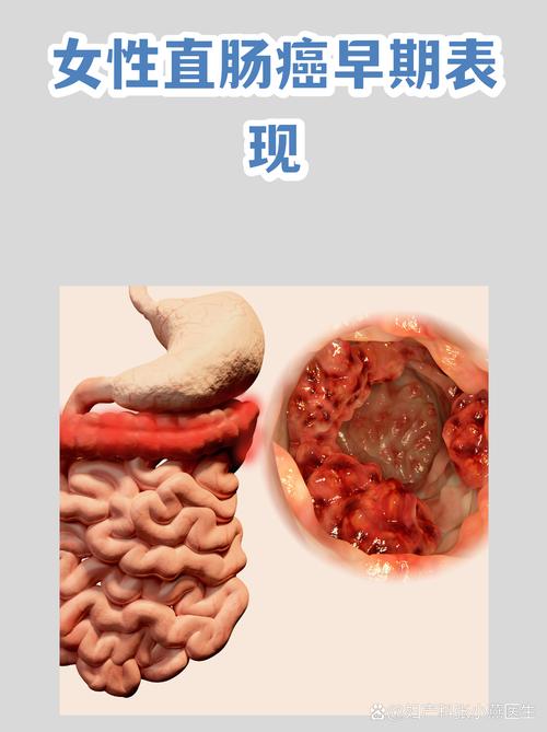 女生拉稀拉肚子