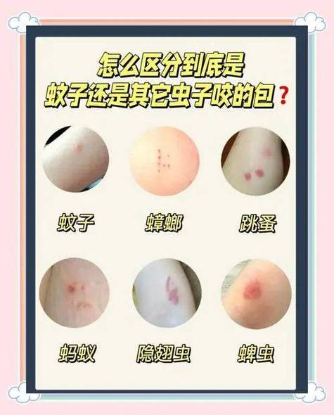 虫咬后凸起硬包要警惕