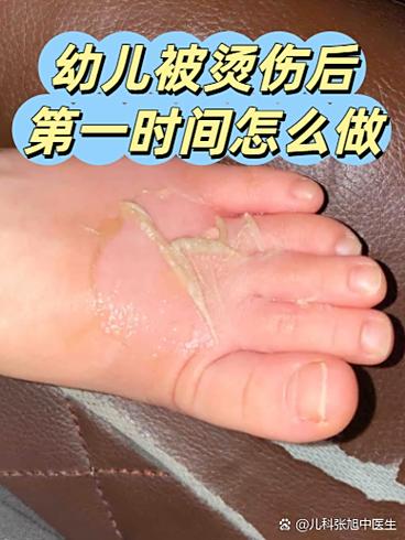 蚂蚁医生截图