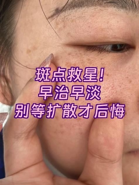 后置摄像头拍照有斑