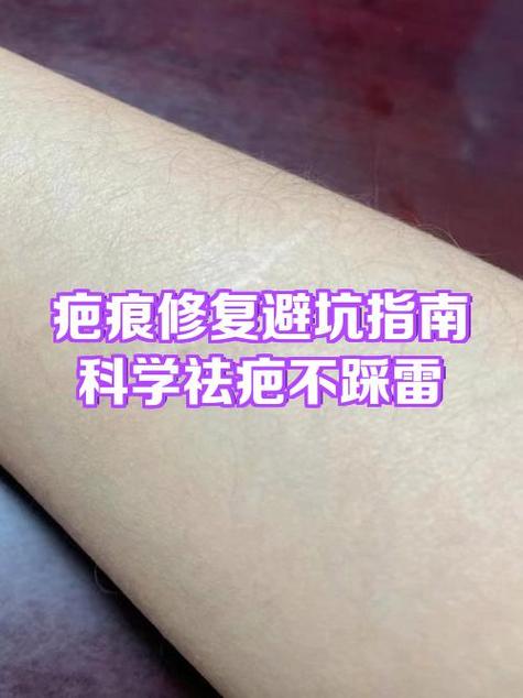 疤痕修复哪个医院最好截图