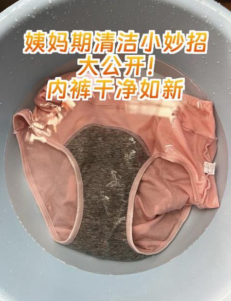 内裤发黄清洗小妙招缩略图