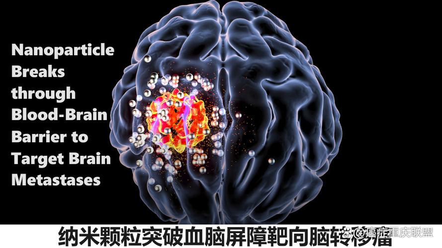 ommaya是什么意思
