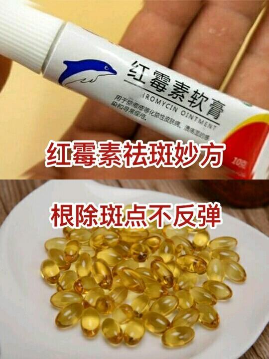 红霉素祛斑正确的方法缩略图