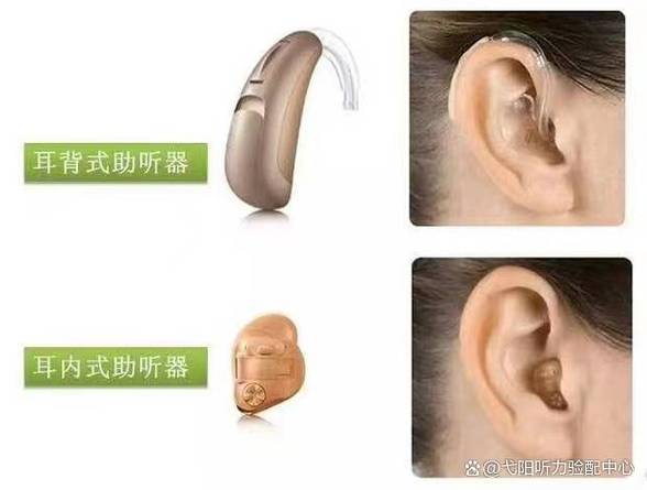 力斯顿助听器价格表图标