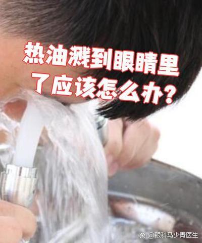 眼睛里溅到热油怎么办截图