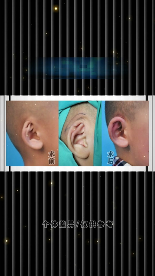 监控说话对方怎么听不到