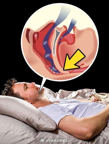 男人睡觉流口水咋回事截图