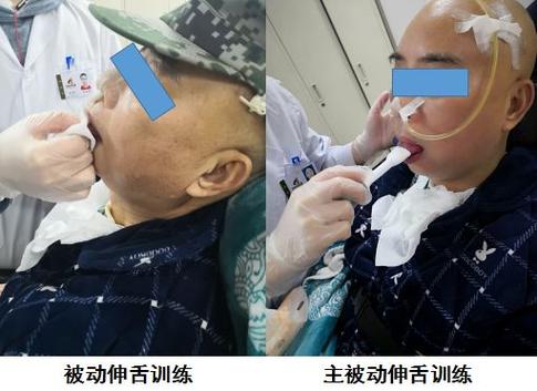 舌根有红色泡吃什么可以消掉截图