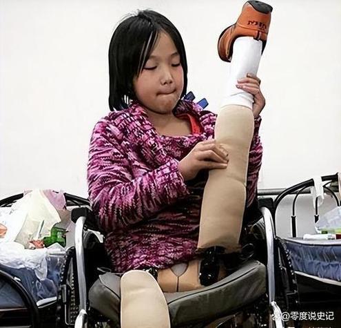 腿部残疾少女图标