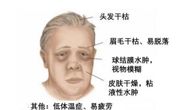 为什么视频里脸变大了截图