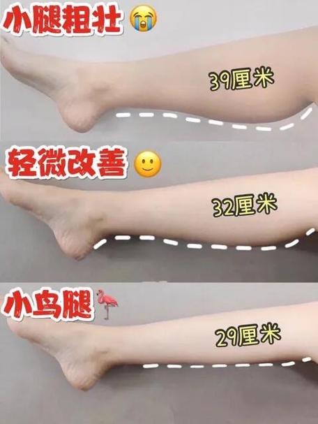 怎样锻炼小腿变粗壮