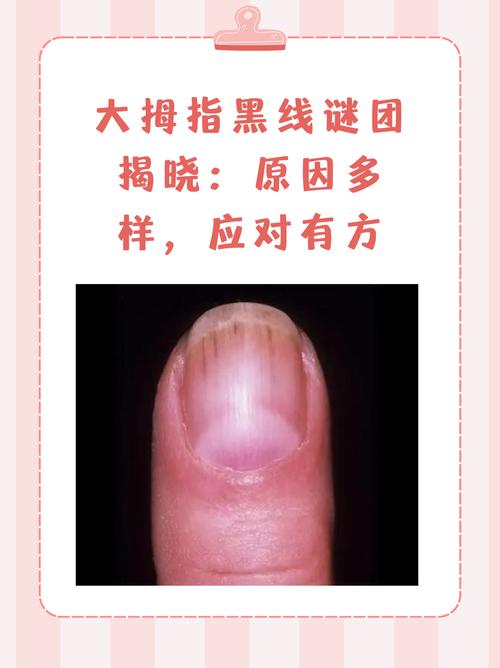 打开微信上面一条黑杠是什么意思缩略图