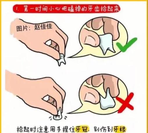 怎么让松动的牙齿快速掉下来截图