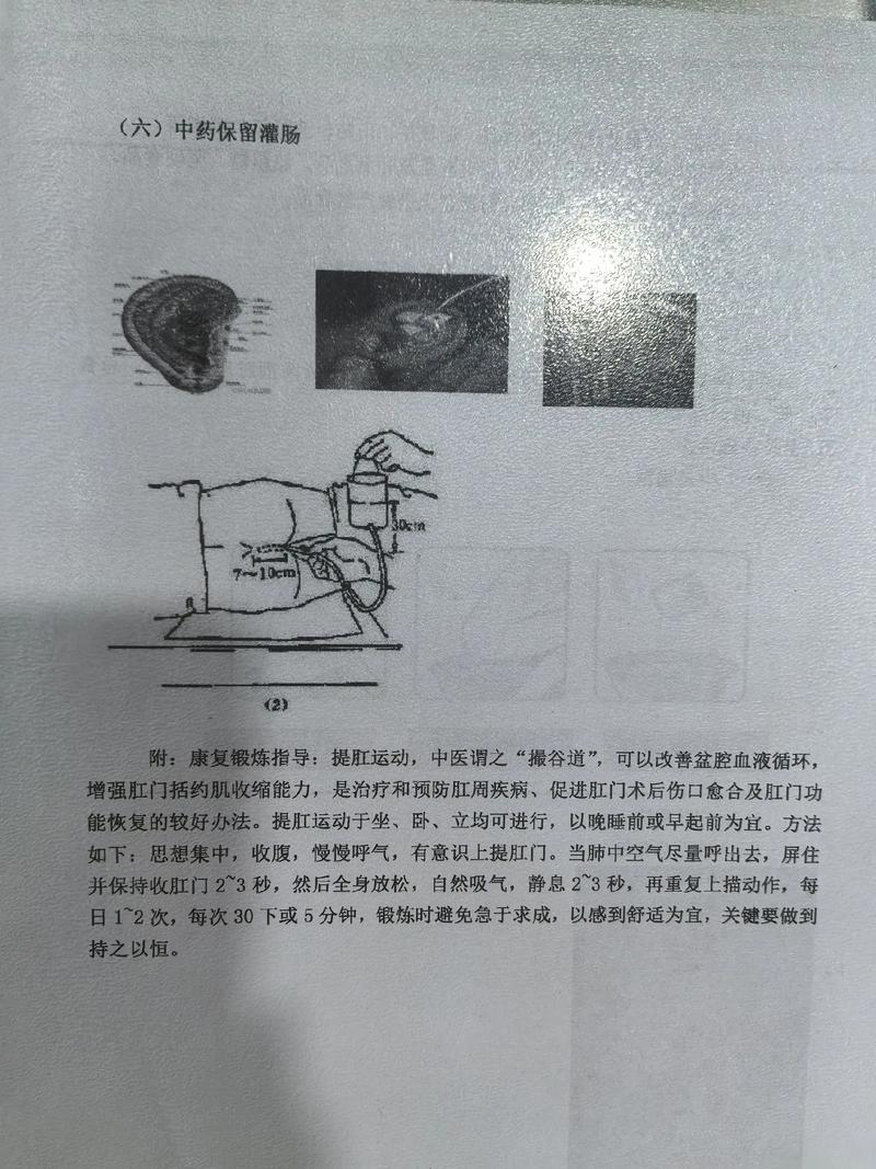 关于肛门的刑法截图