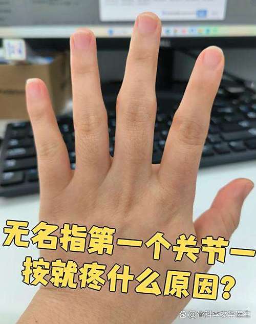 手指关节一捏就疼缩略图