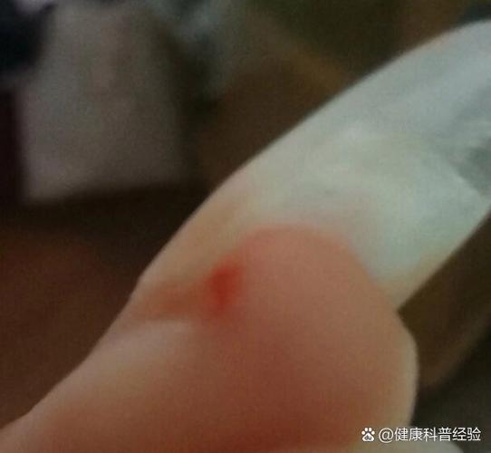 金丝熊咬人死亡几率游戏截图