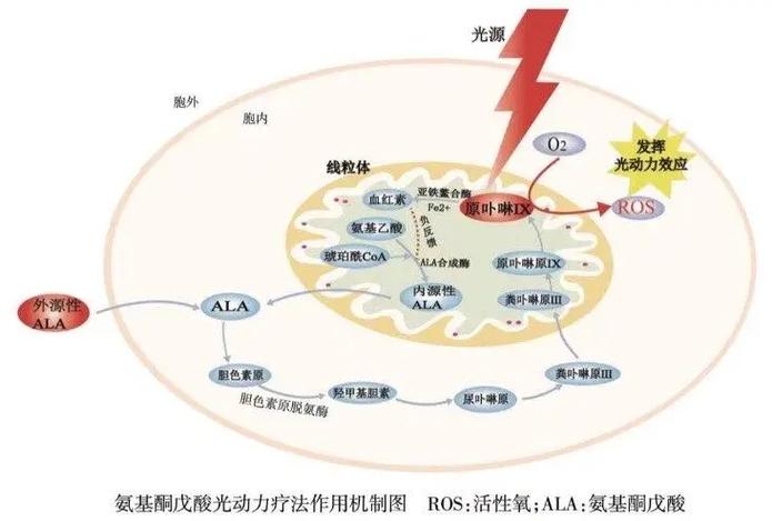 PDT治疗是什么意思游戏截图