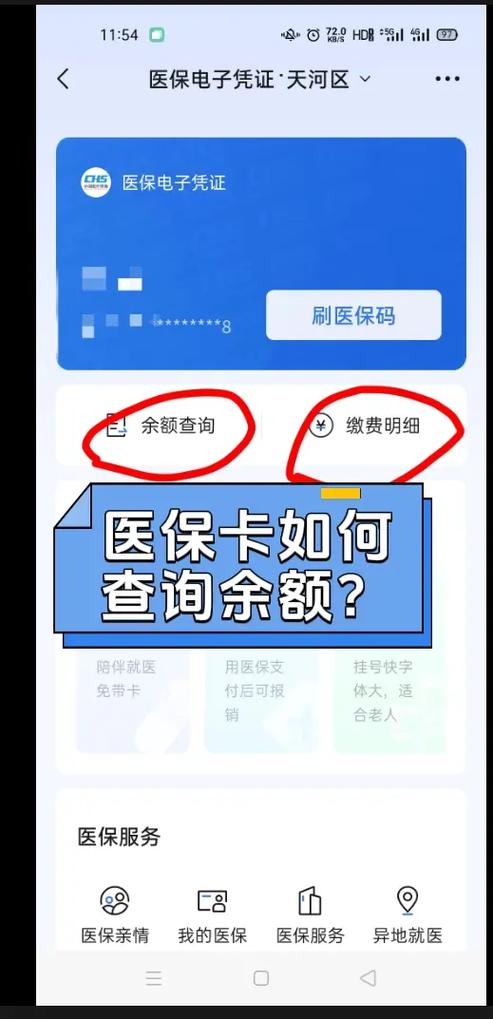 医保卡怎么能刷出来