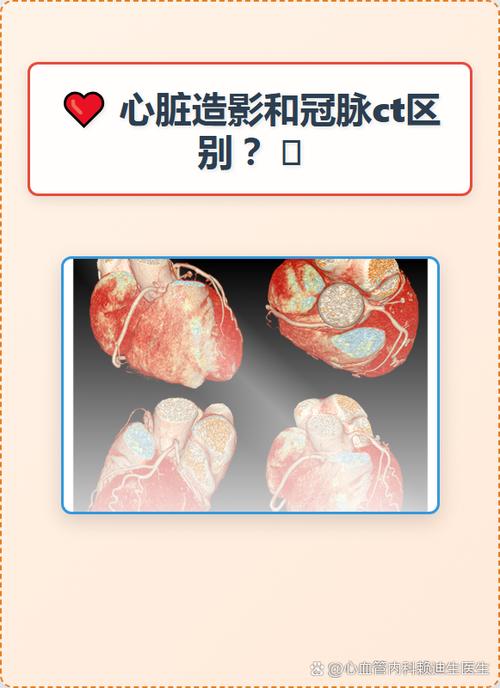 ct血管成像和造影有区别吗游戏截图
