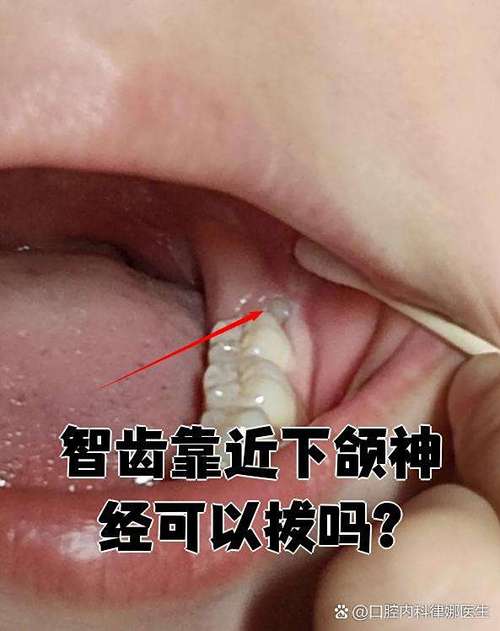 智齿在哪个位置图片