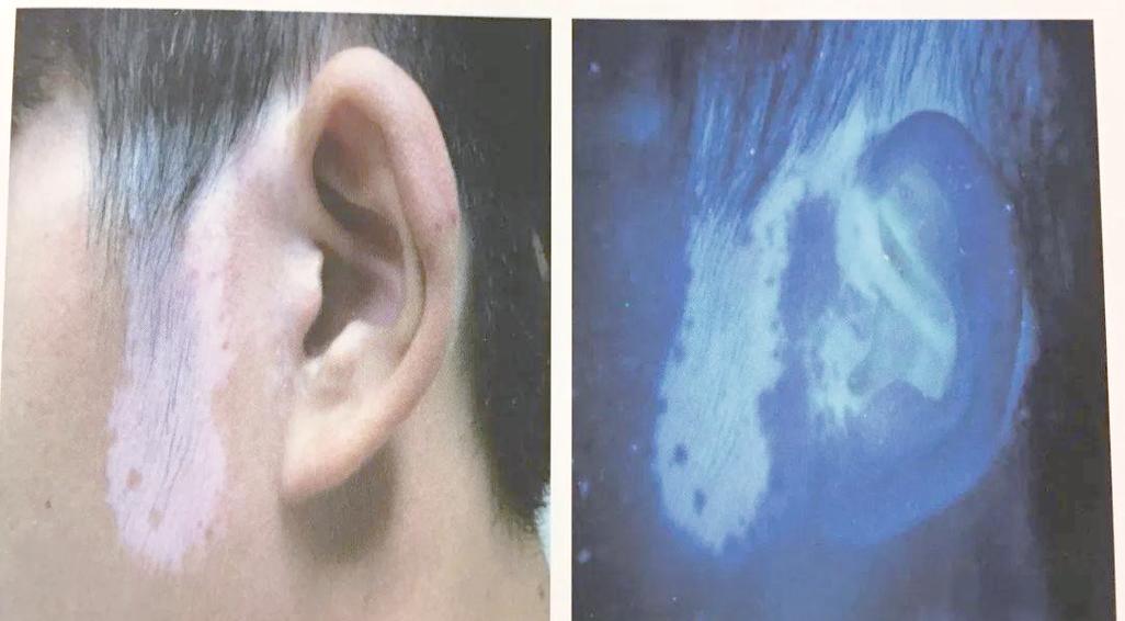 手机屏幕上出现蓝色斑块截图