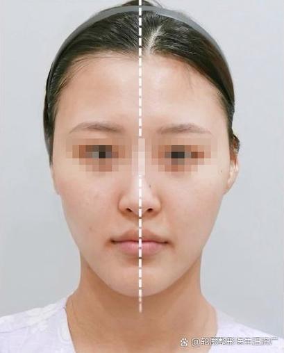 拍照脸歪照镜子脸不歪游戏截图