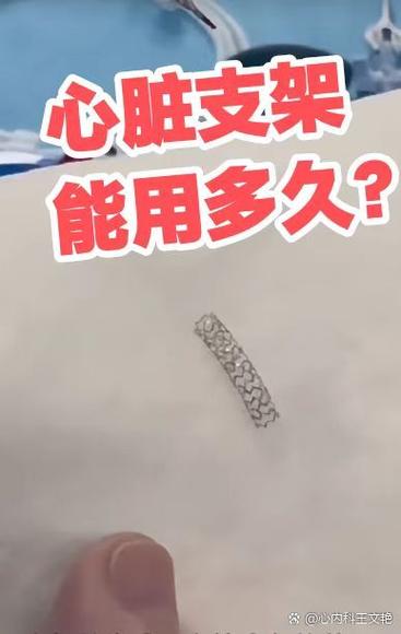 一个支架的寿命是多少年游戏截图