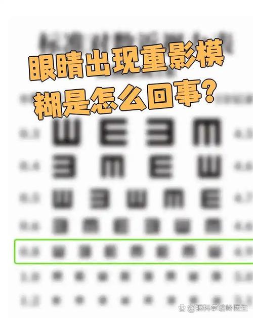 眼前出现重影是怎么回事缩略图