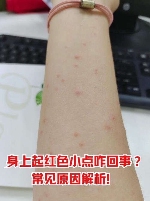 身上长红点是什么原因造成的缩略图