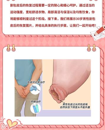 皮沙发表层掉了一层薄皮游戏截图