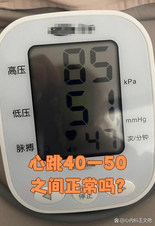 静息心率低于50正常吗