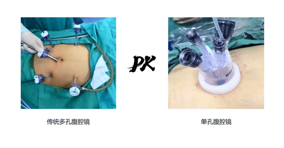 只能用一个鼻孔呼吸截图