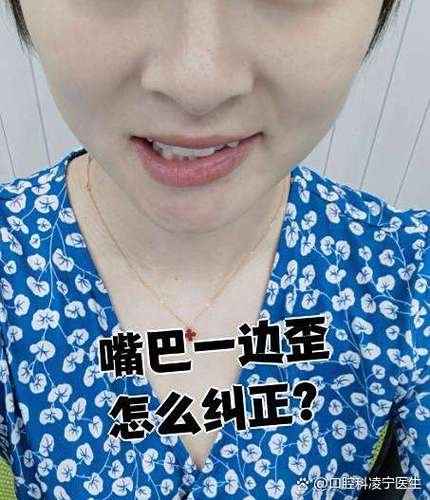 后置拍出来嘴歪是真的歪吗图标