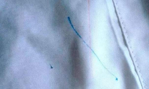 衣服上的笔迹怎么去除小窍门截图