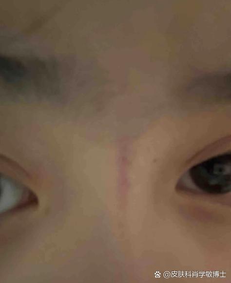 手机屏幕有一条紫色竖线缩略图