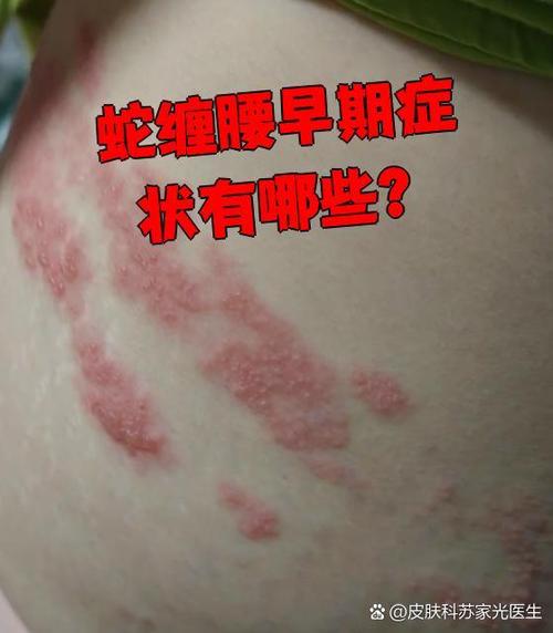 两个蛇缠绕是什么征兆截图