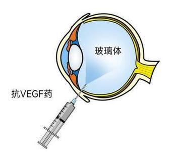 电脑不显示打开的窗口缩略图