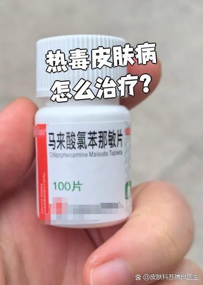 热毒皮肤病怎么治疗图标