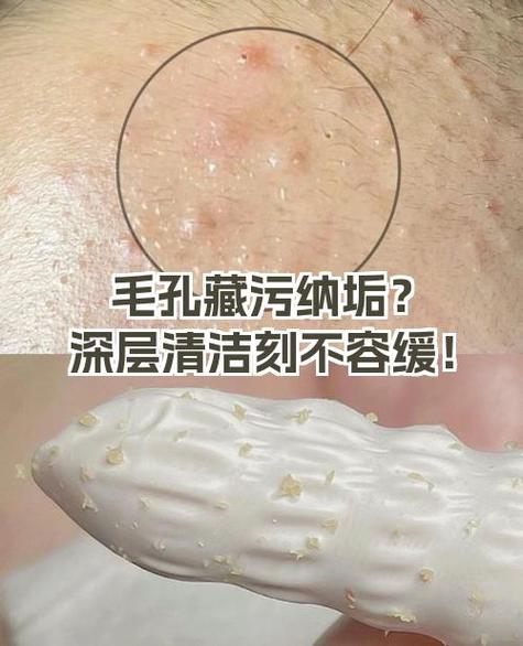 膏药沾到皮肤怎么清除干净图标