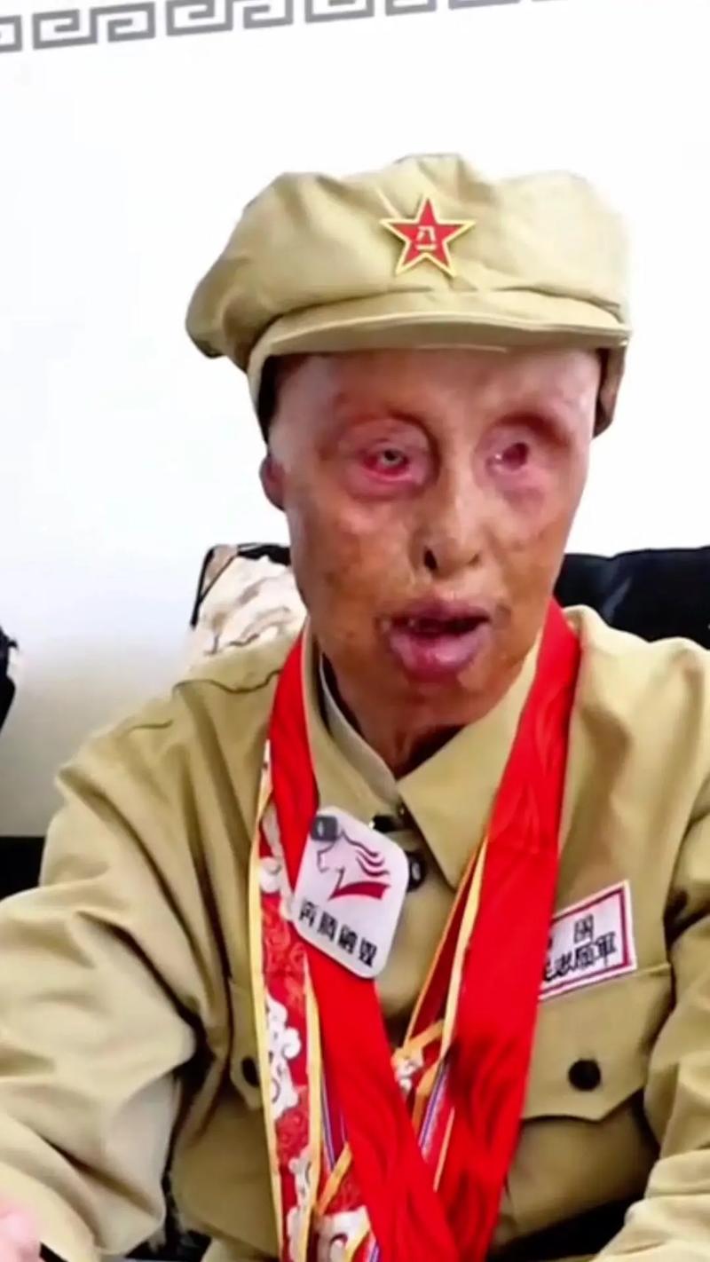 英雄联盟老英雄