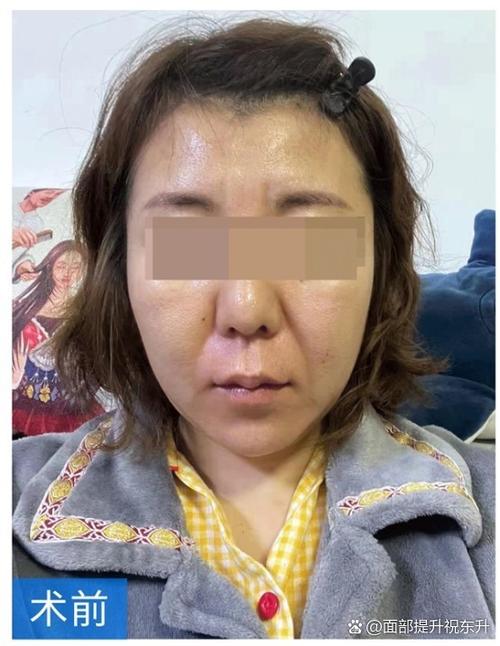 脸垮了还能养回来吗截图
